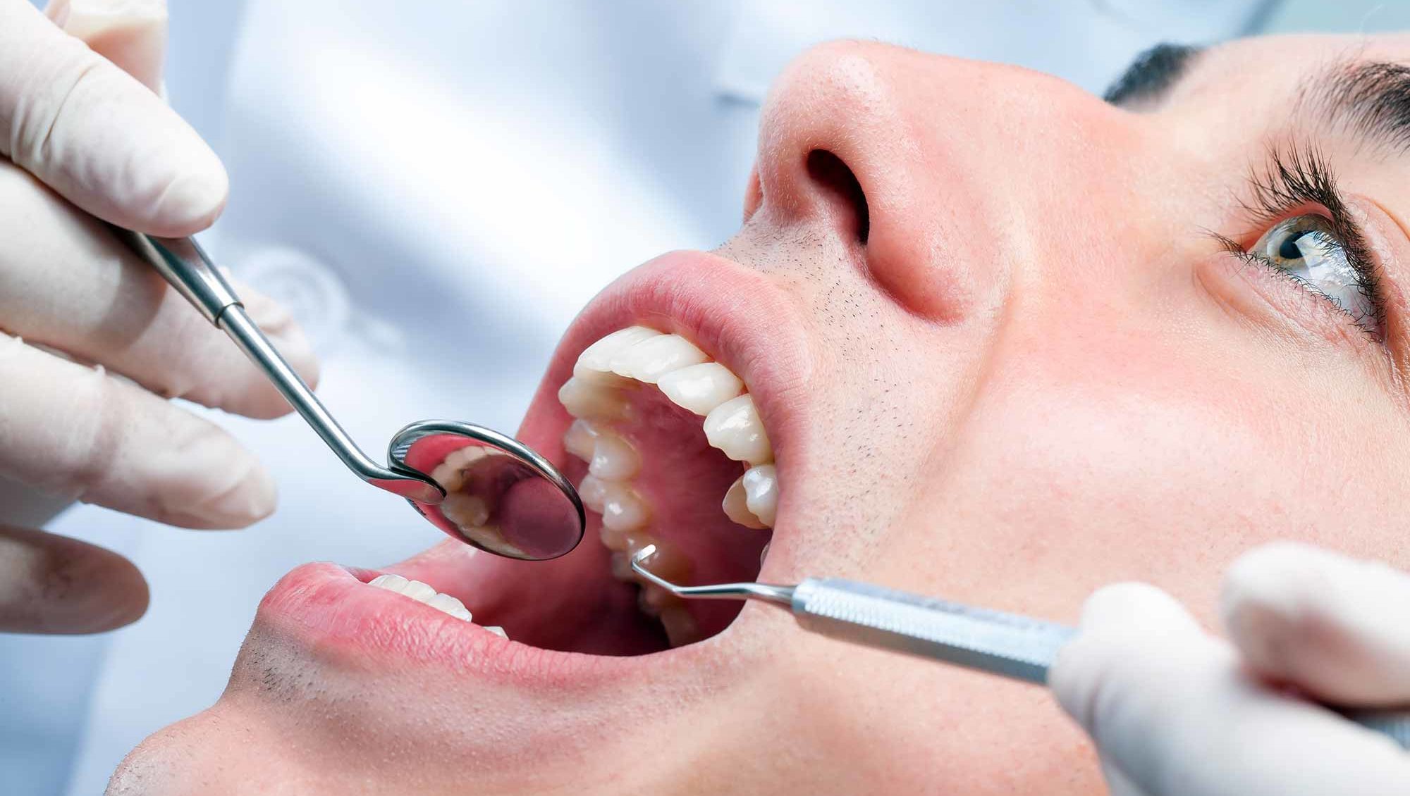 Why is Gum Disease Linked To COVID-19 Patients?