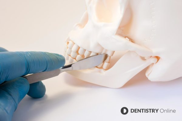 Implant Dentistry Today examines the latest papers published on bone regeneration and socket preservation