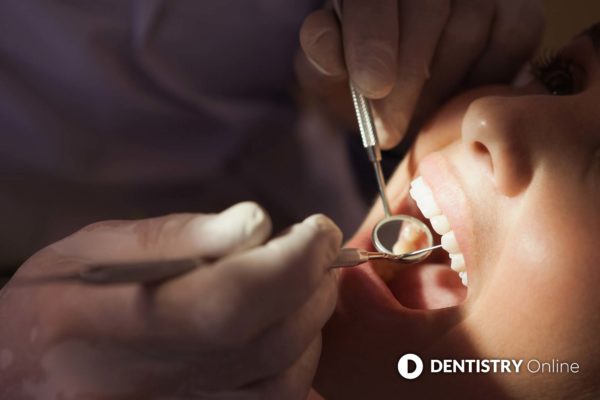 dentist using BEWE to check erosive tooth wear