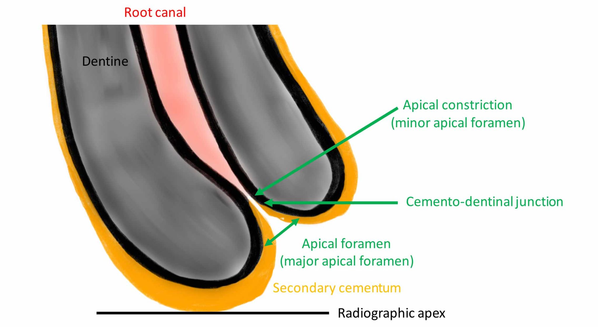 Apical Meaning Dentistry