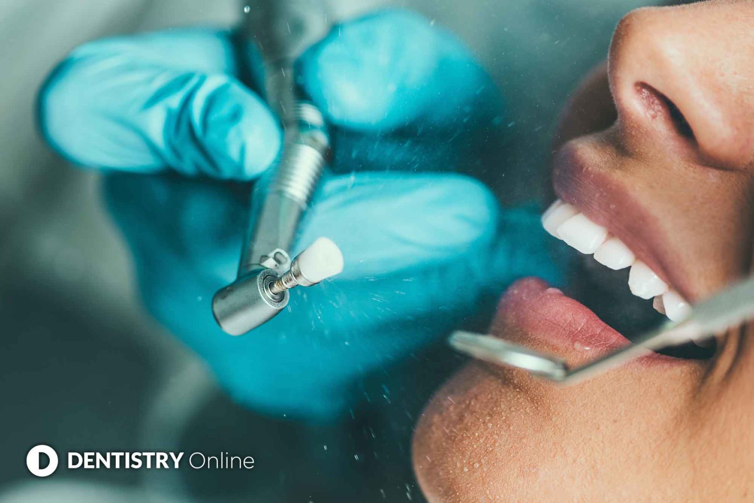 To polish or not to polish? Prophylaxis during COVID Dentistry Online