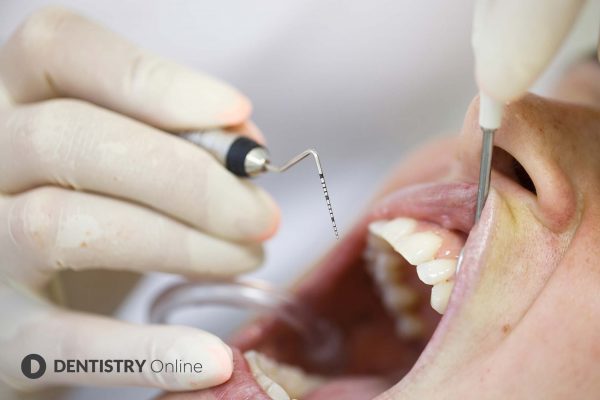 checking for gum disease (periodontitis)