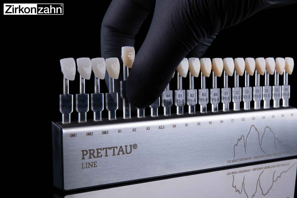 Prettau zirconia shade guides identical to final restoration Dentistry