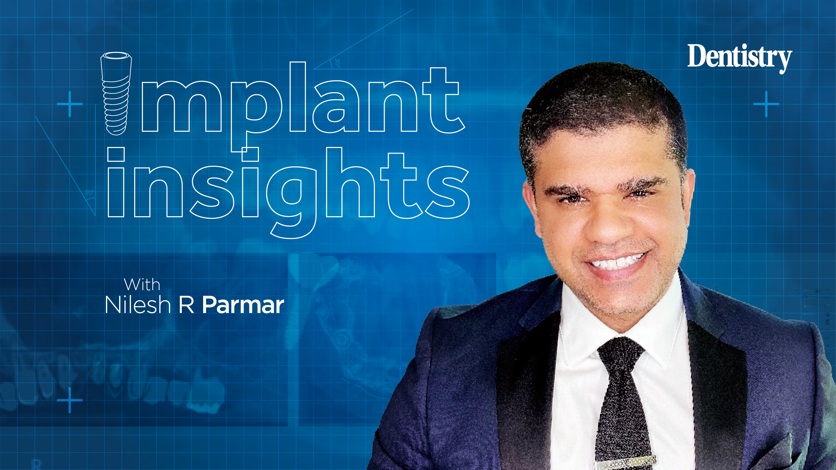 implant insights