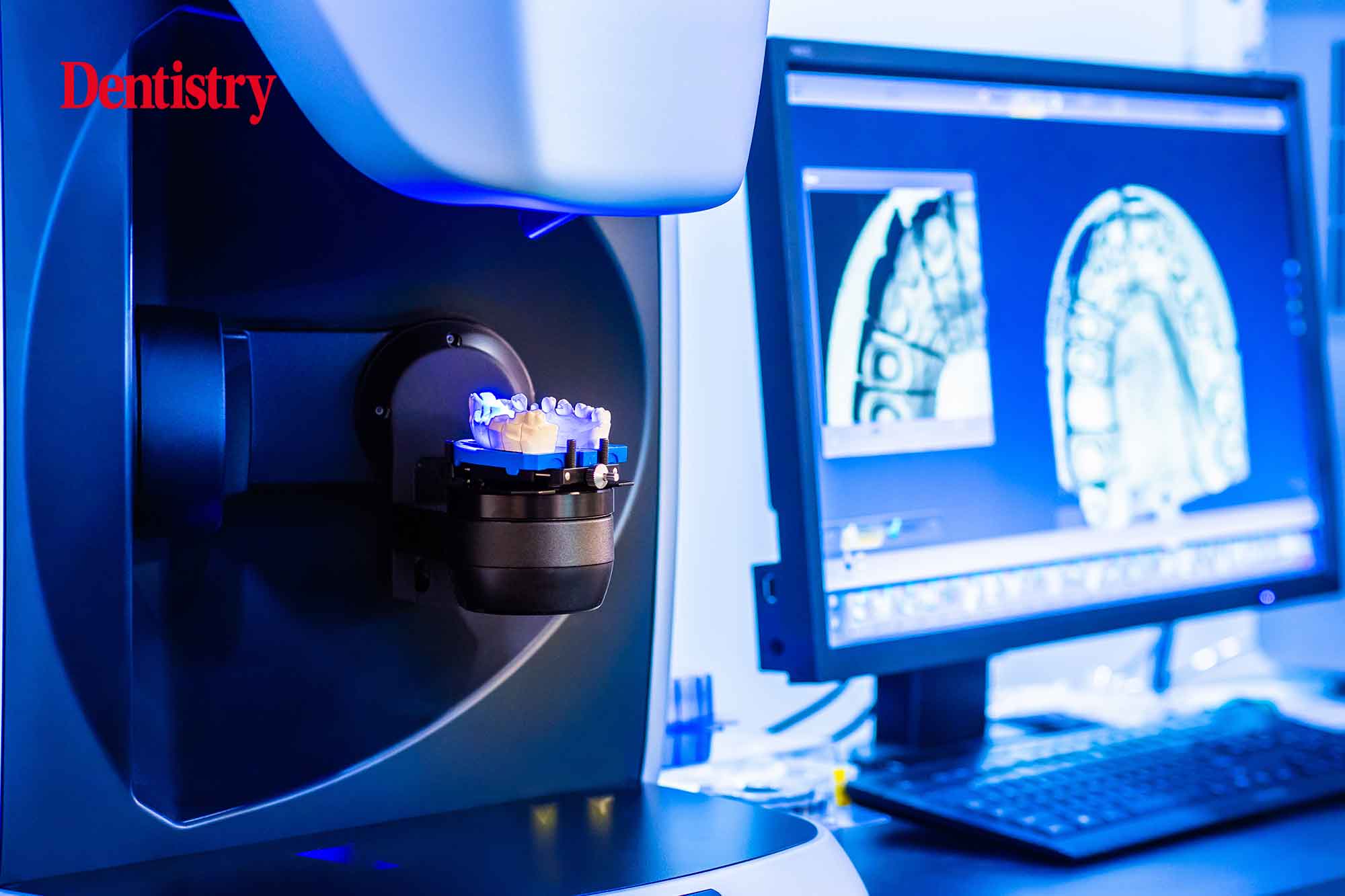 Digital Dentistry in dental lab