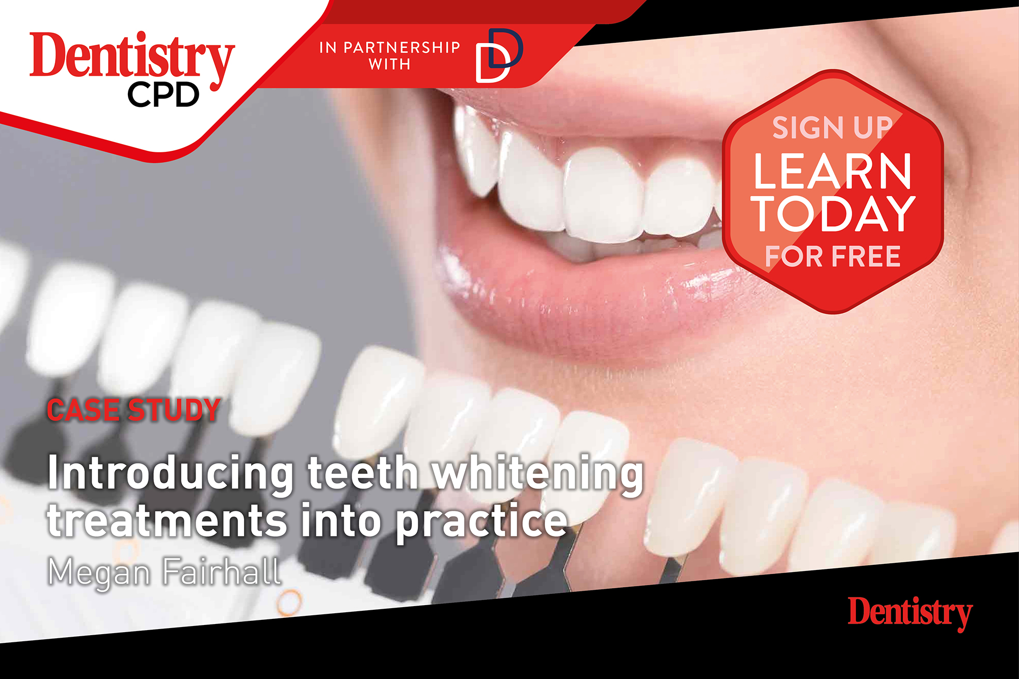 Dentistry CPD: new this week – introducing teeth whitening treatments into practice
