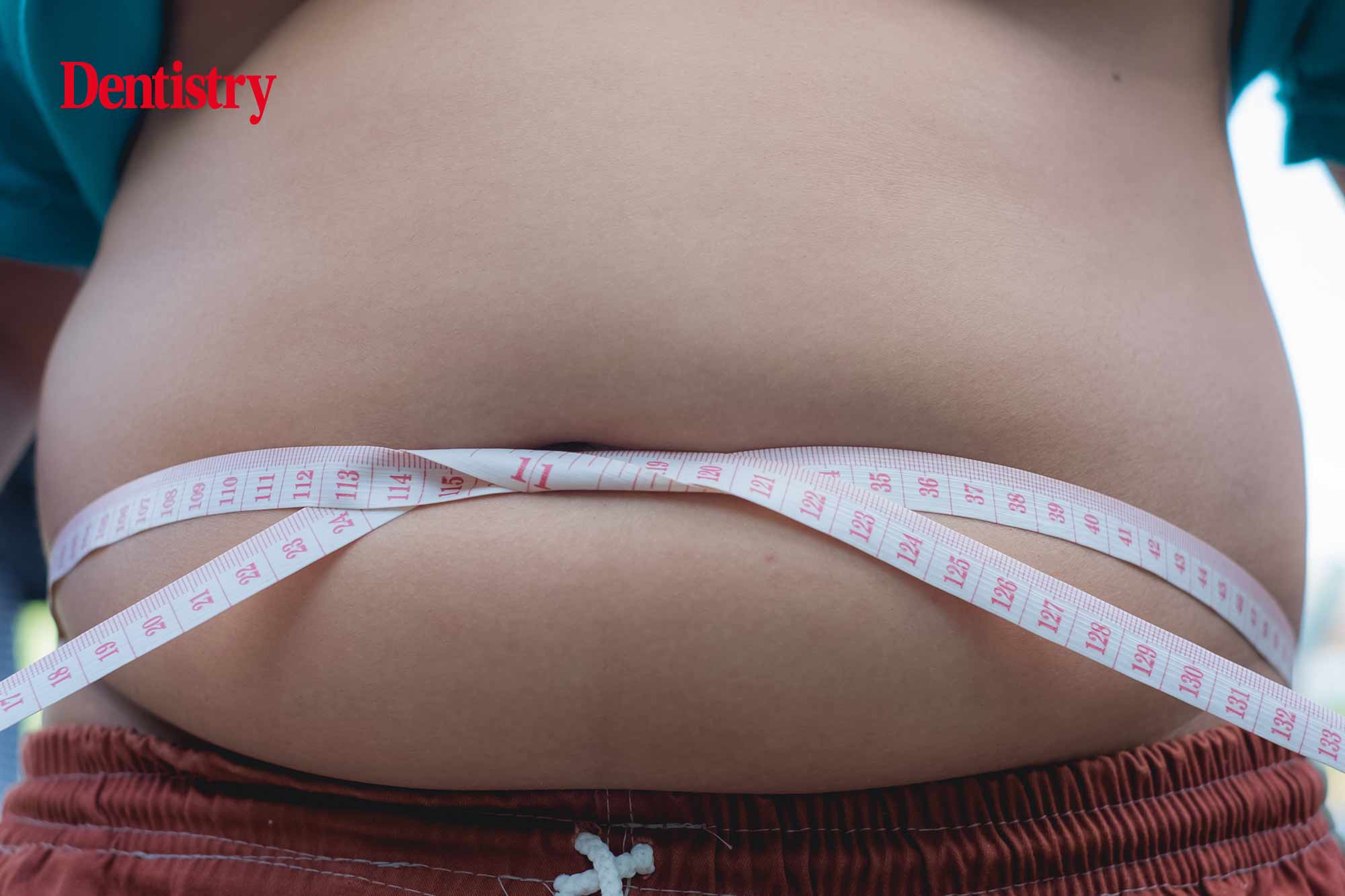 Children grow up obese due to health inequalities, says think tank