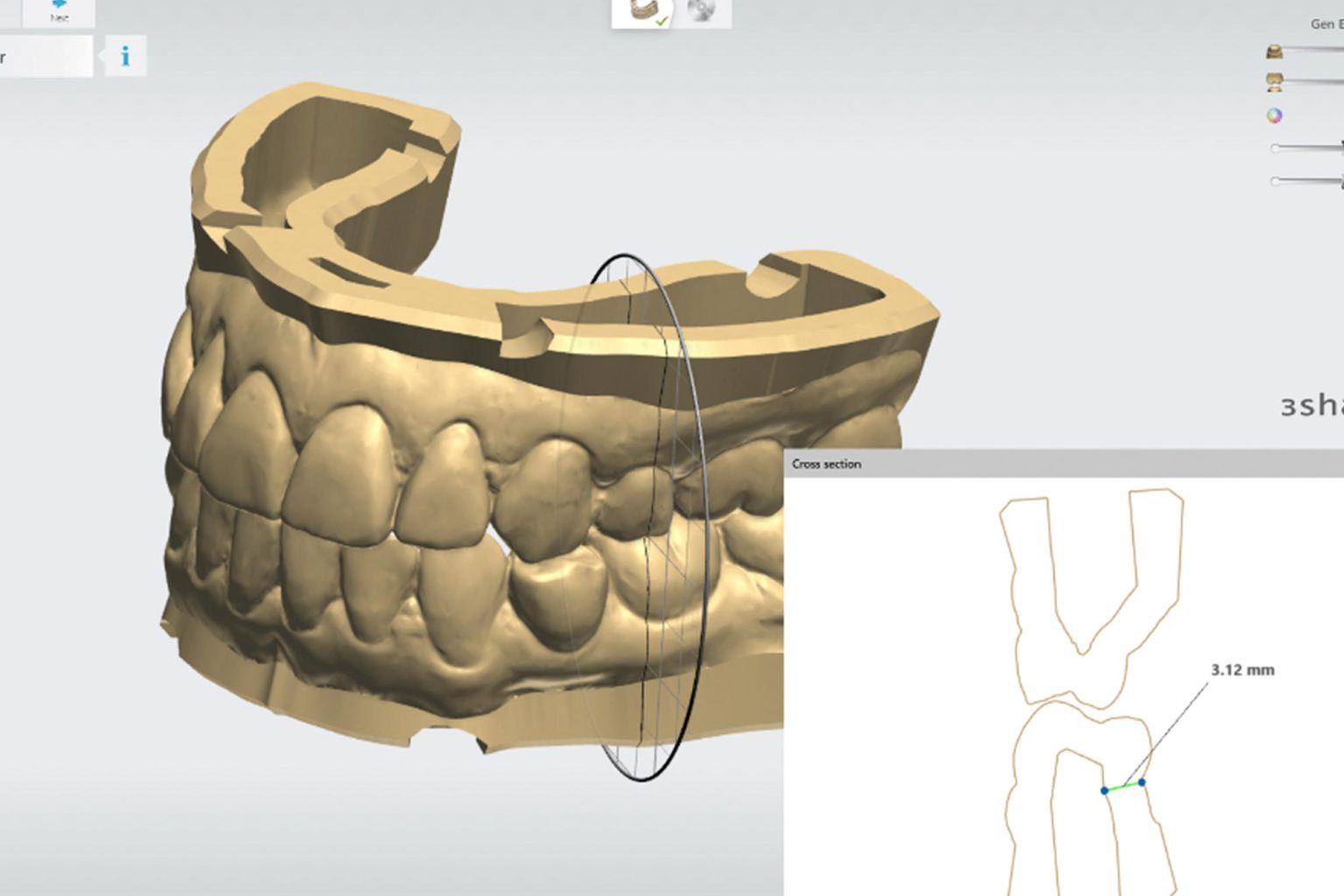 3shape Model Maker create dental models in minutes! Dentistry