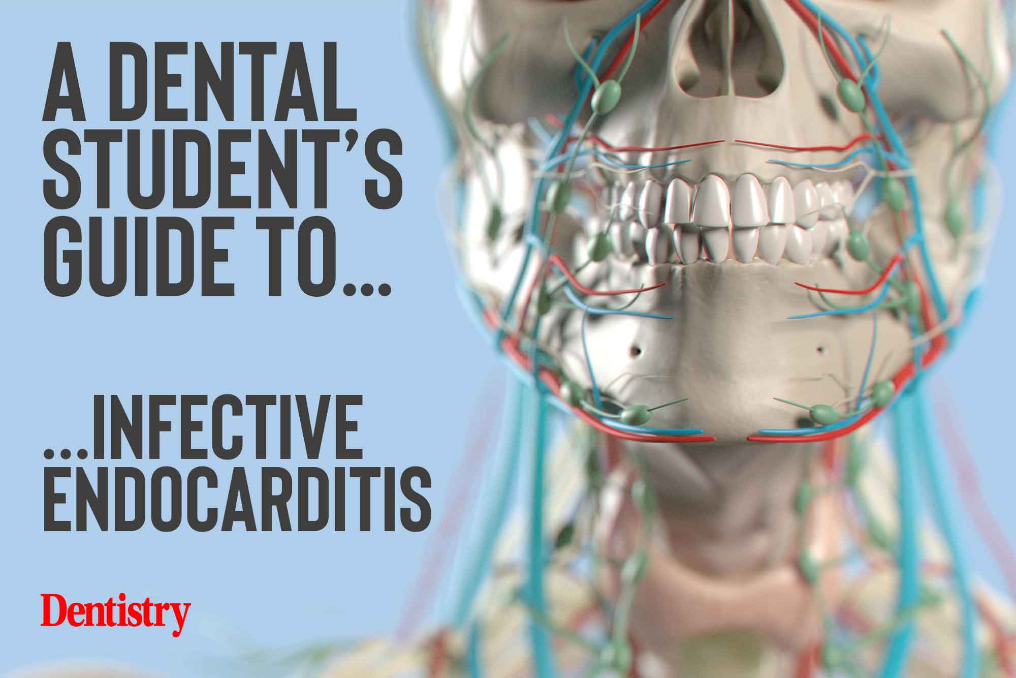 Infective endocarditis