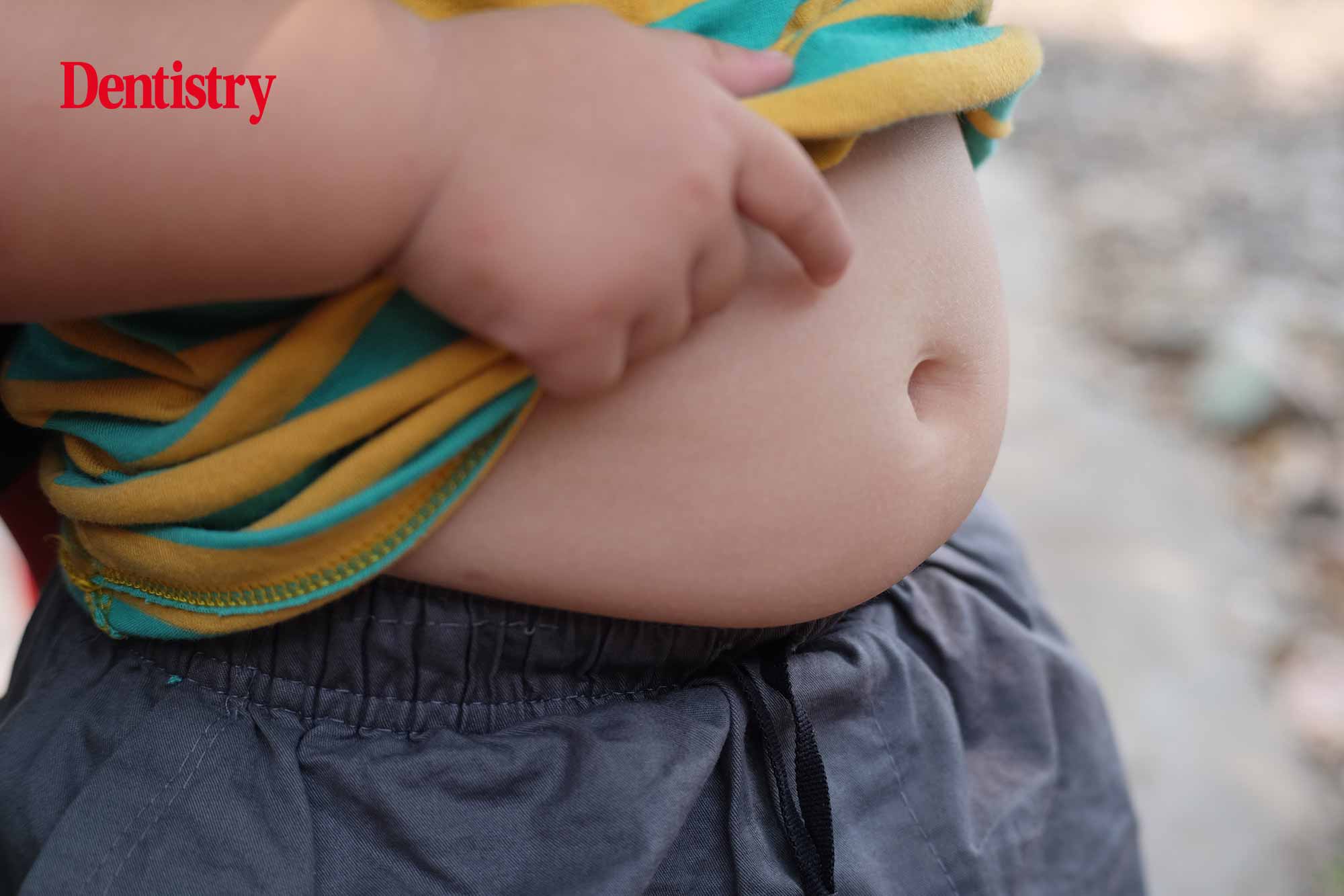 Increase in children with diabetes linked to obesity