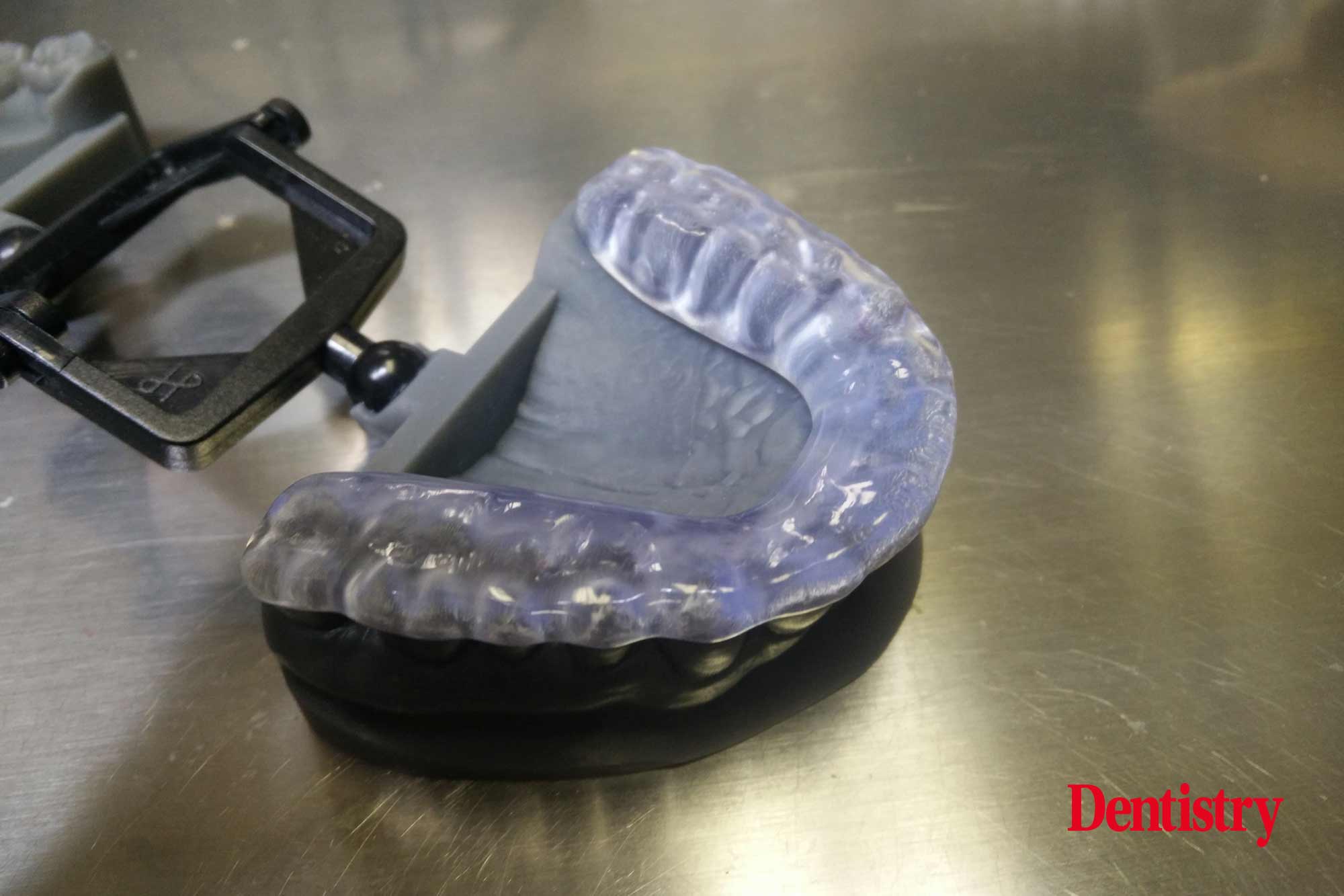 Andre Gaul RDT gives a step-by-step overview of the design and fabrication process of printed occlusal splints.