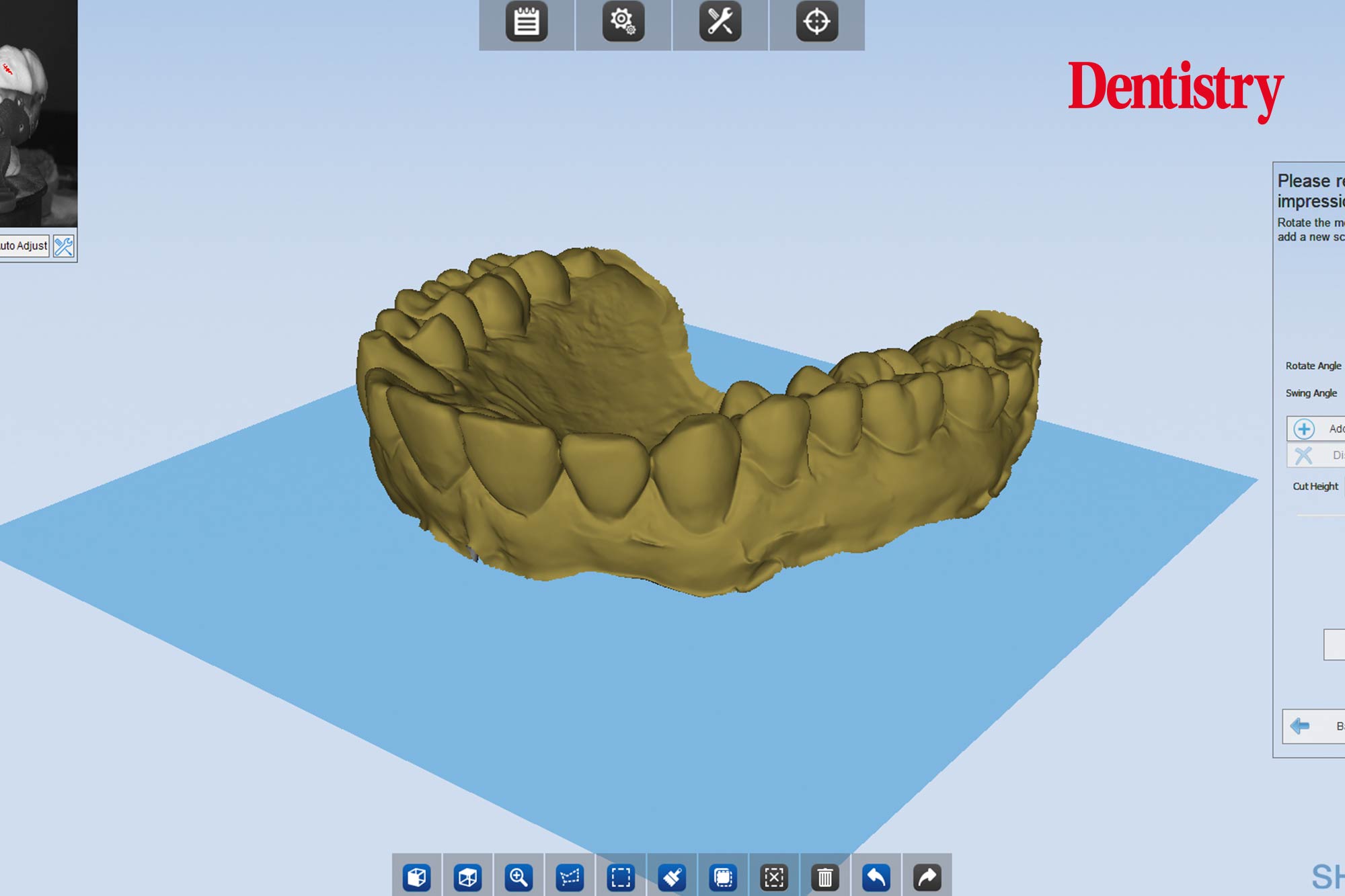Andre Gaul RDT gives a step-by-step overview of the design and fabrication process of printed occlusal splints.