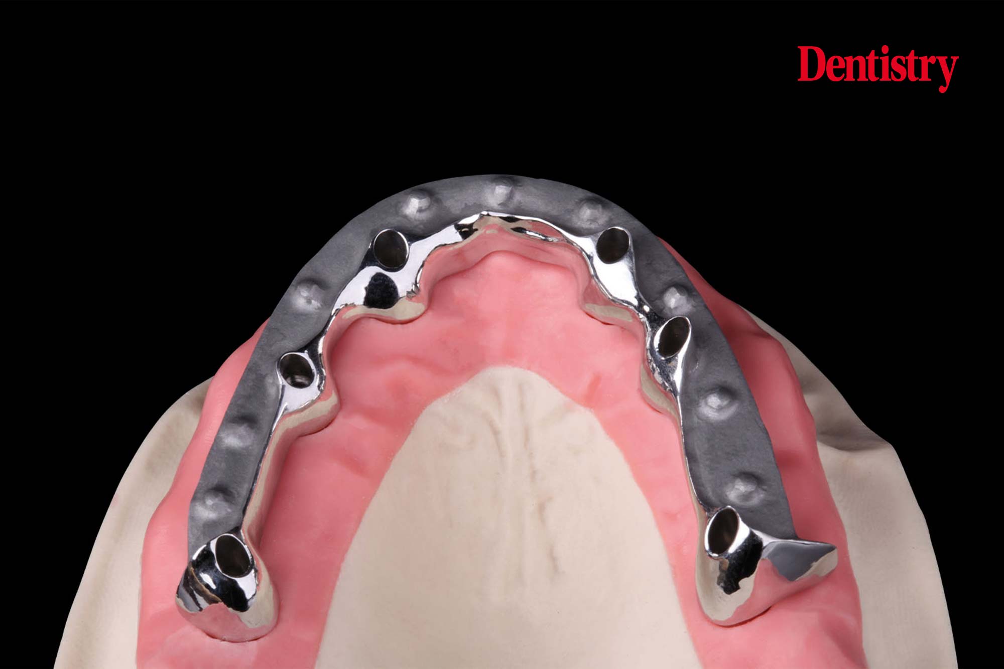 Four solution approaches for aesthetic restorations on divergent implants