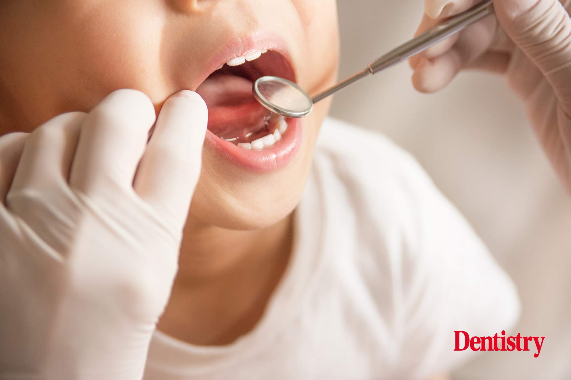 Untreated tooth decay is still prevalent in children aged three to 11, new research shows, as the government is urged to tackle the UK oral health crisis. 