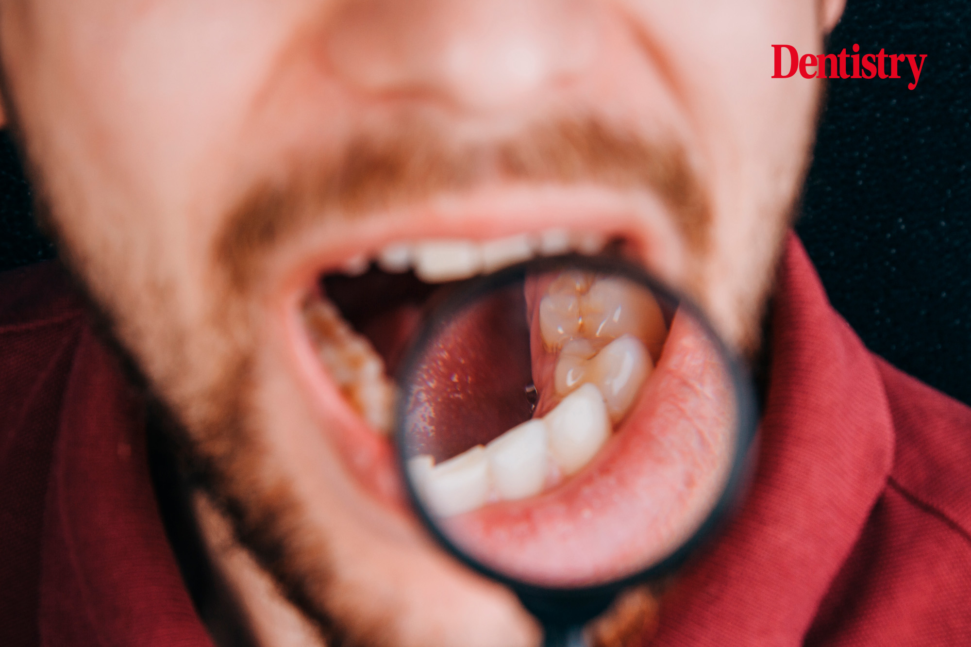 With oral cancer on the rise in the UK, Debbie Herbst discusses the importance of knowing the signs and making an early diagnosis.