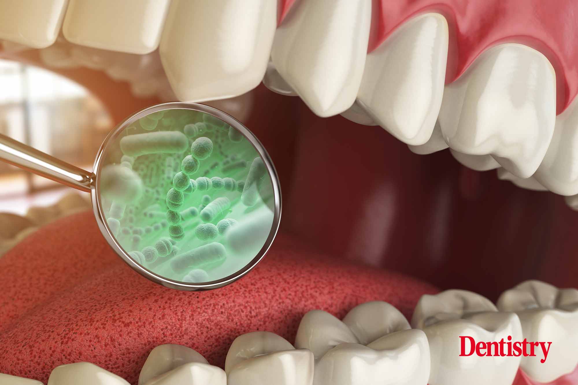 Ahead of the Guided Biofilm Therapy Summit in London this September, speaker Victoria Sampson shares her insight into the oral microbiome and how understanding it fully can help to support patients in their oral health efforts between appointments.