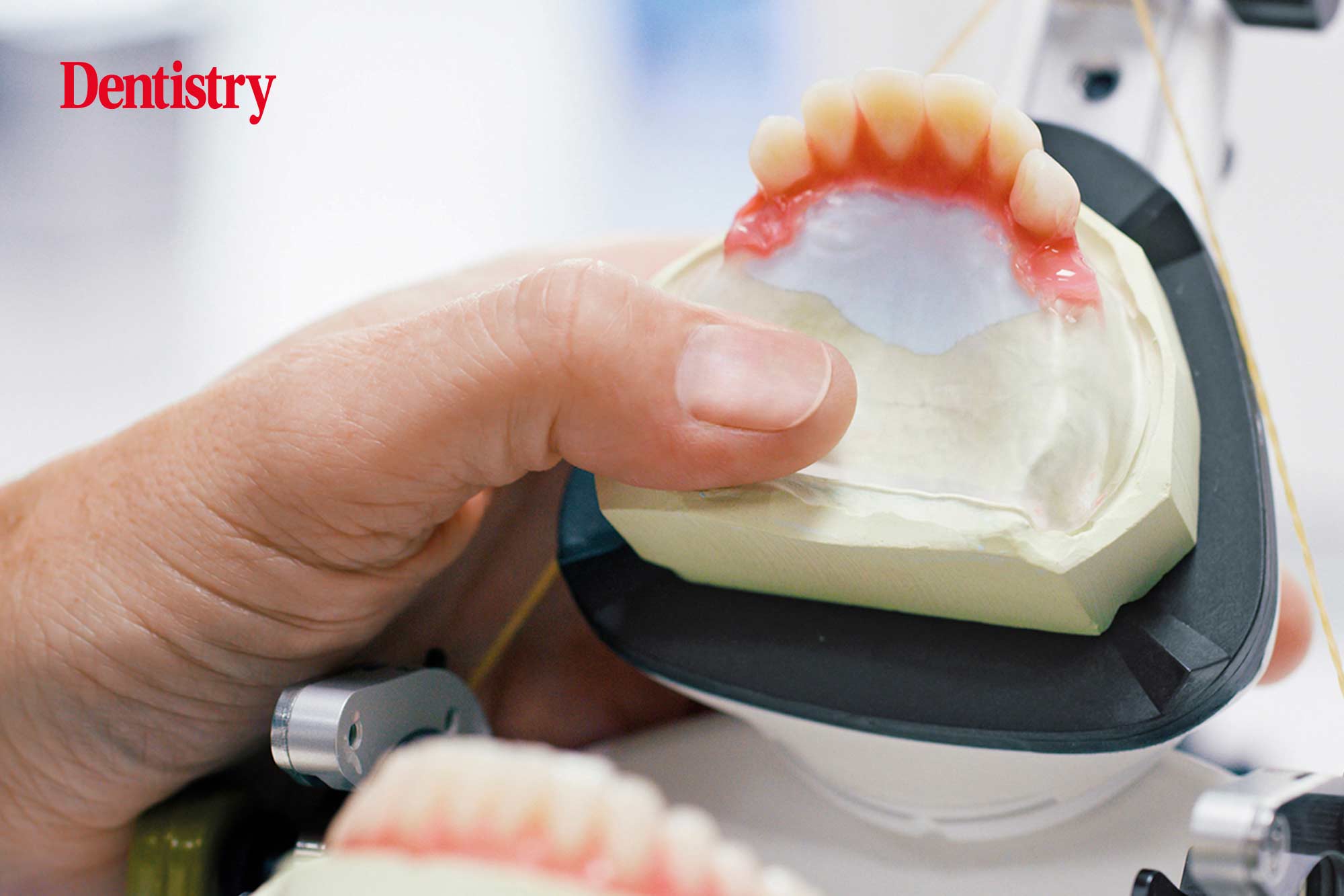 Celebrate the evolution of dentures with Ivoclar