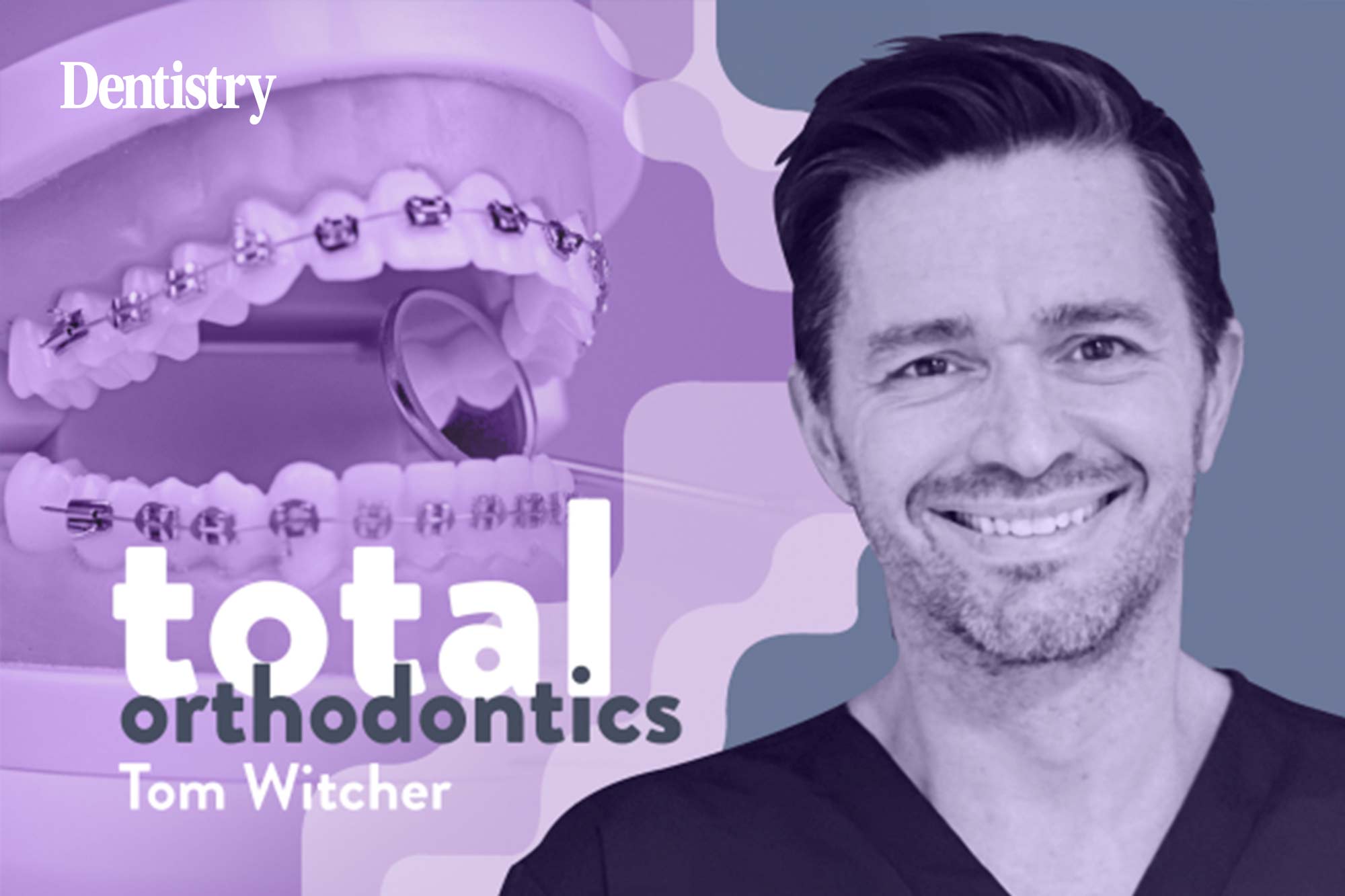 Tom Witcher, a specialist orthodontist at Total Orthodontics Lewes, part of Bupa Dental Care, shares his method for deciding whether to extract poor prognosis first molars in mixed dentition.