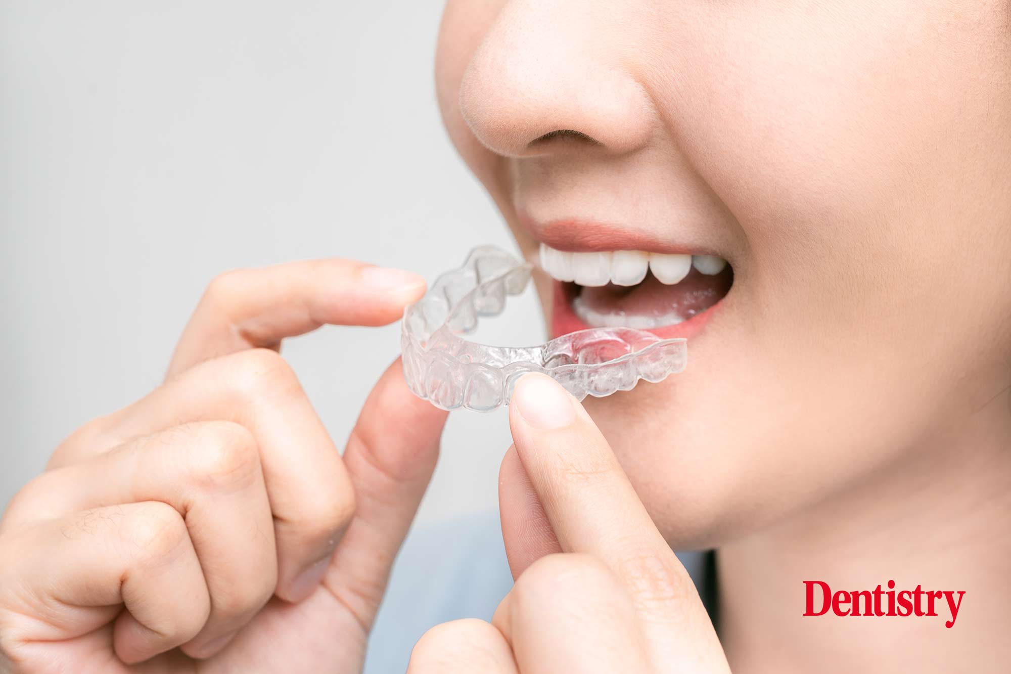 DIY orthodontics is potentially dangerous, BOS reiterates