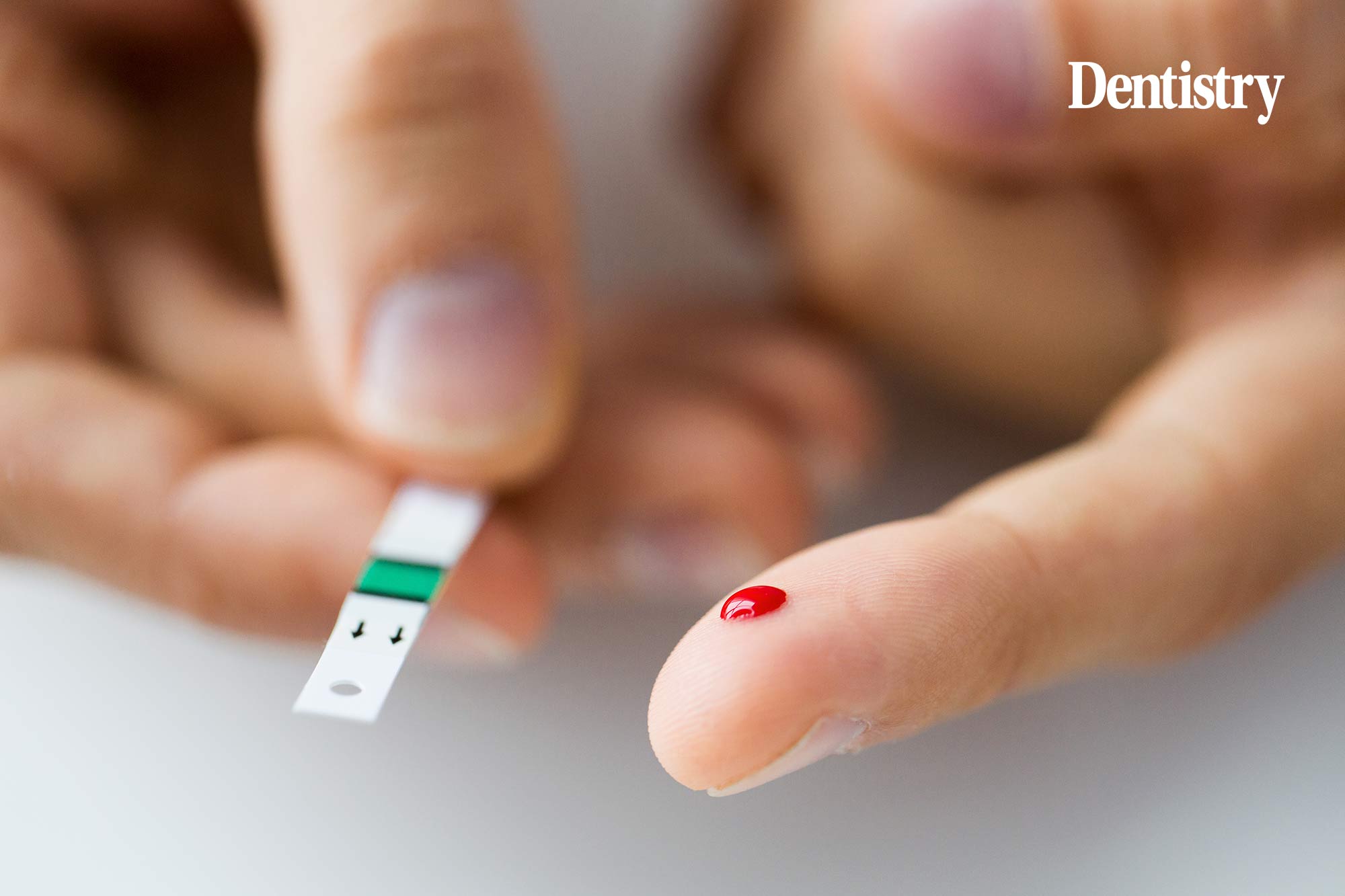 Stark increase in type 2 diabetes among UK's under 40s