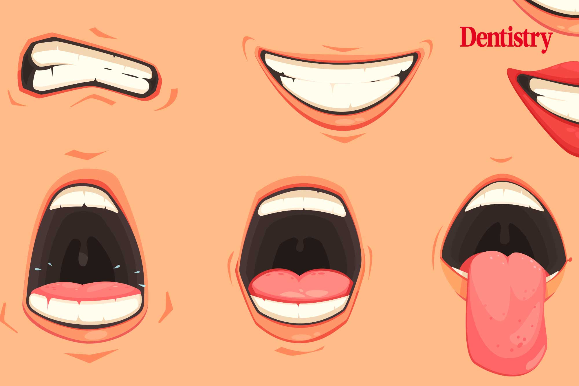 Mouth Cancer On The Rise In UK Says Report Dentistry