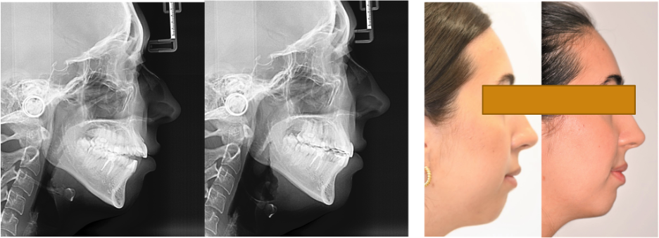 Pic 3 - Cephalometrics