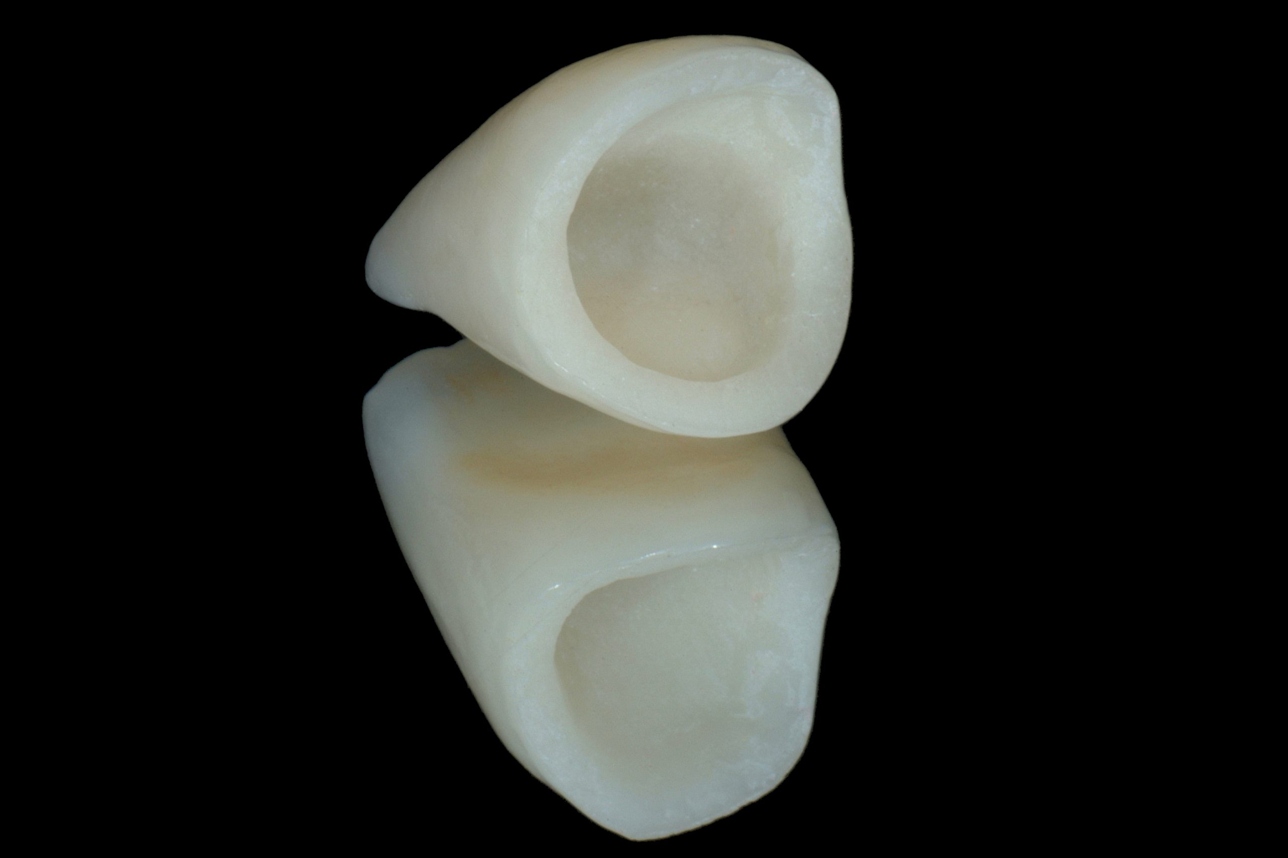 Ceramic Crown_013f Dentistry.co.uk