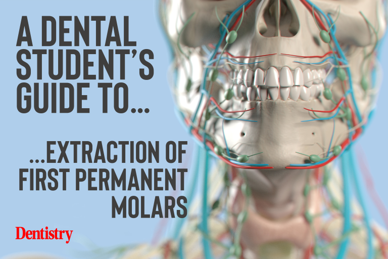 Dental Student's Guide first permanent molar extraction Dentistry