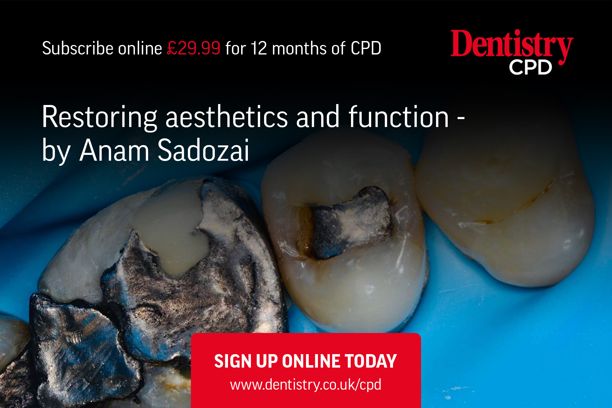 On the topic of aesthetics and function, Anam Sadozai discusses large direct restorations utilising principles of biomimetic dentistry.