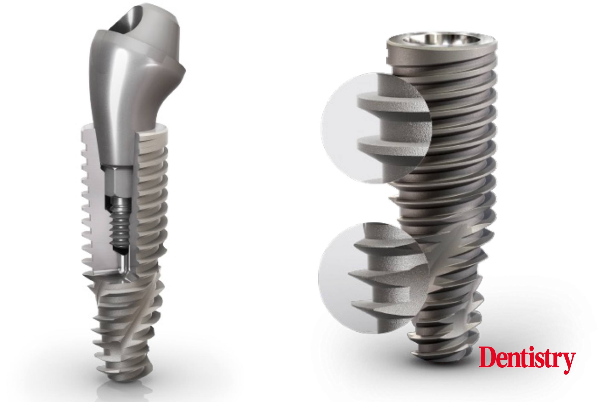 Helix Grand Morse – the versatile solution for all implant cases