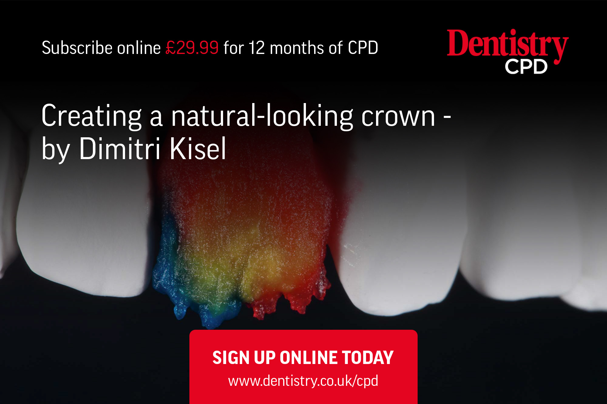 Dimitri Kisel explores how the combination of correct shade and shape brought about a natural looking crown following a challenging implant restoration involving a right upper central incisor.