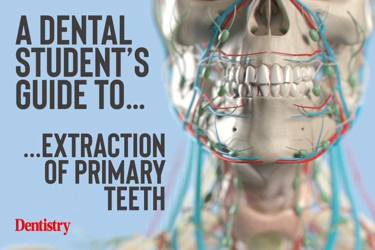 A Dental Student’s Guide to… extraction of primary teeth - Dentistry