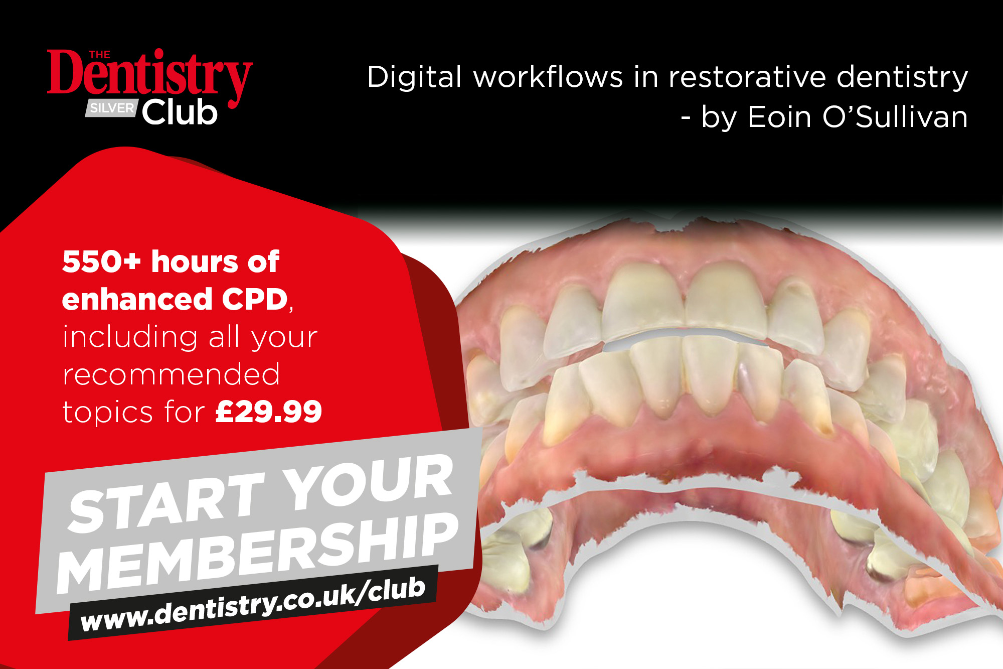 Eoin O’Sullivan explains how digital workflows in restorative dentistry represent a paradigm shift in the way we provide complex restorative dentistry.