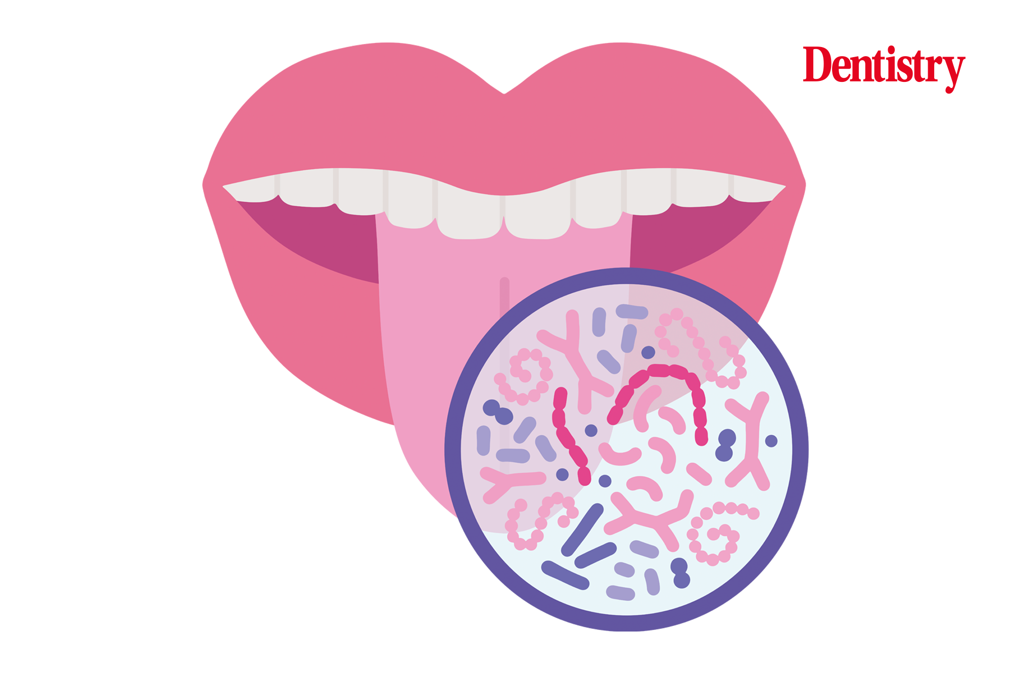 biofilm and its effect on the whole body