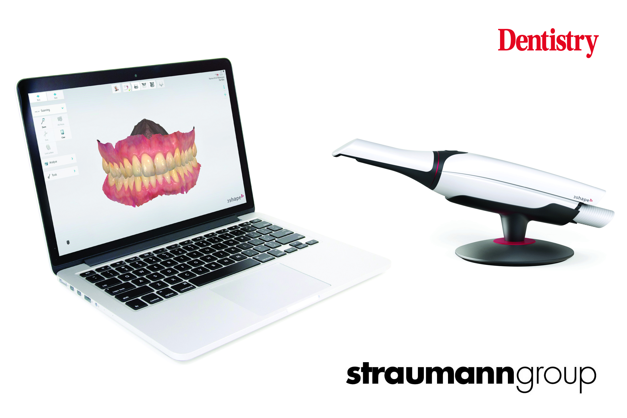 straumann on digital smile design