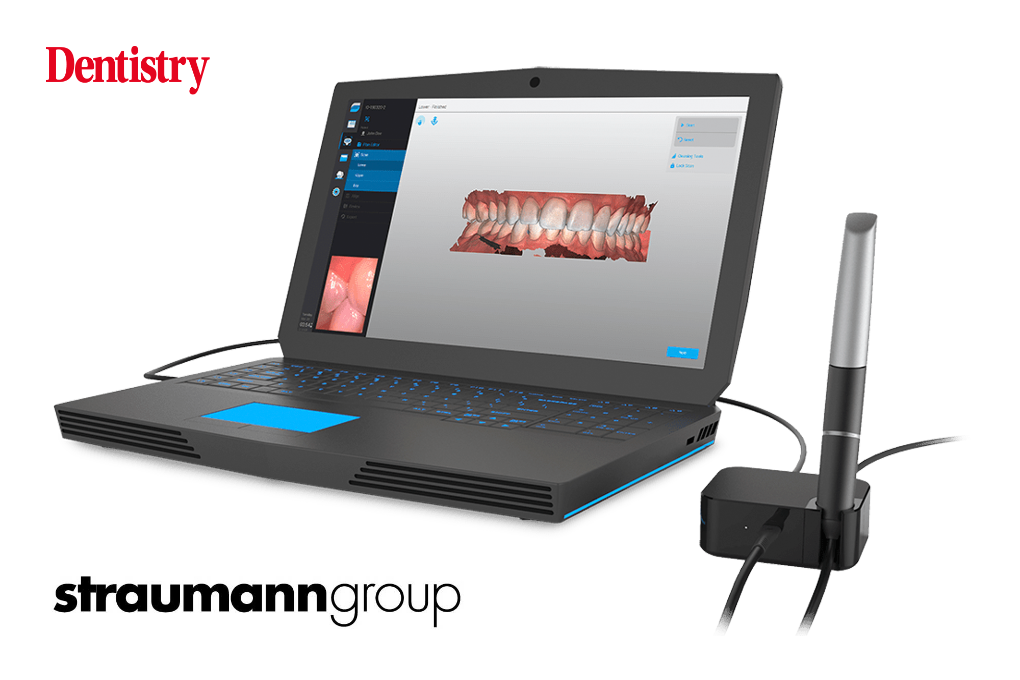 Straumann on digital dentistry