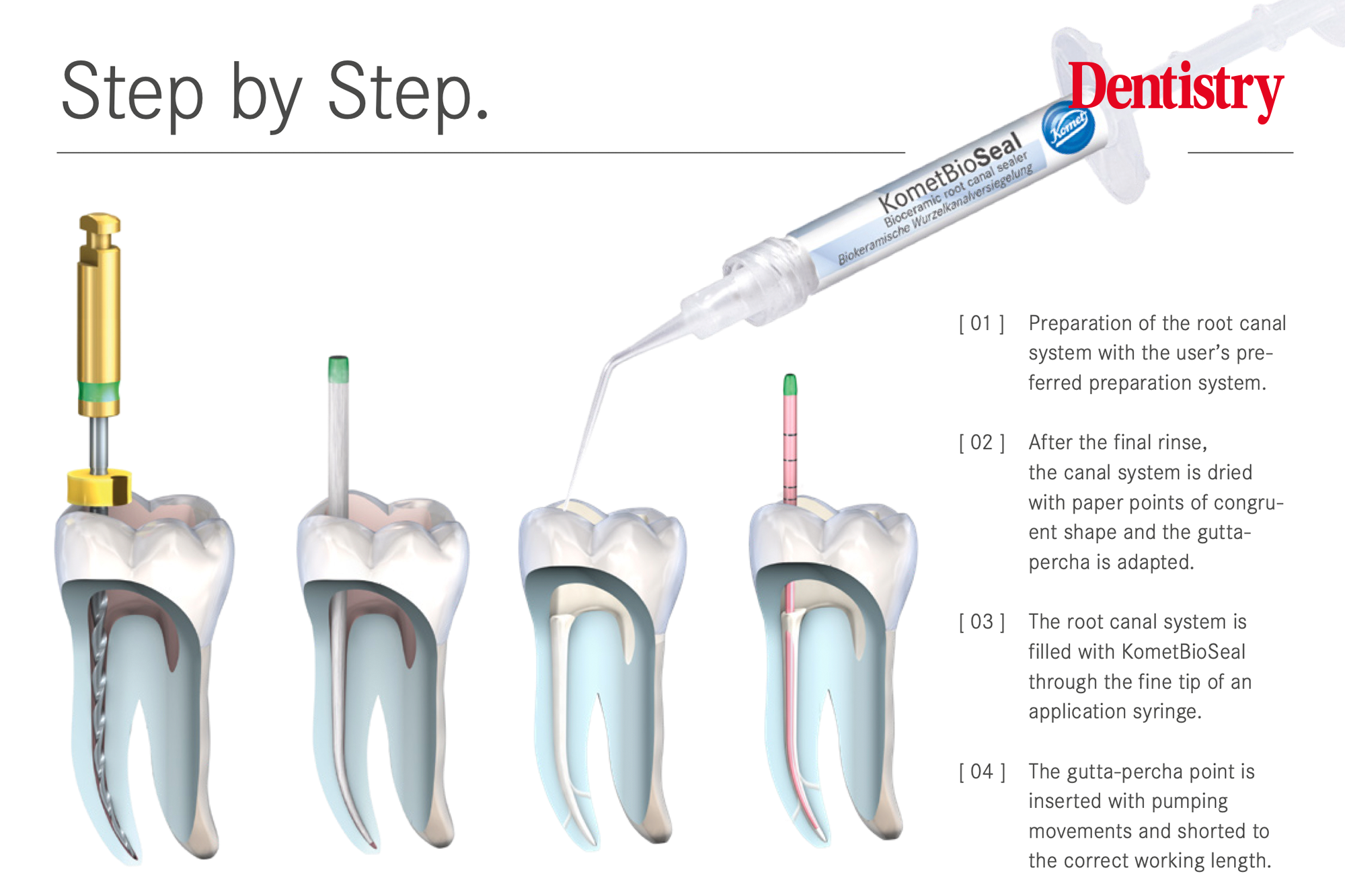 KometBioSeal root canal sealer